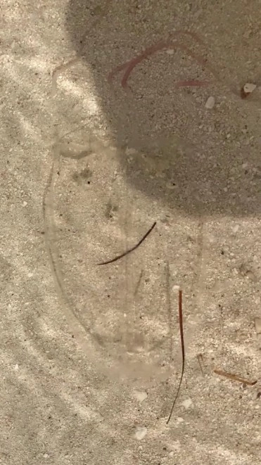 DoE issues advisory on jellyfish stings